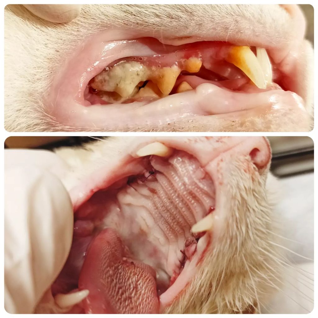 ekstrakcja zębów